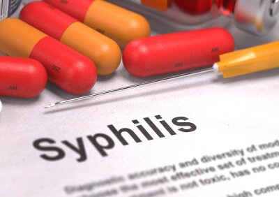Профилактика сифилиса