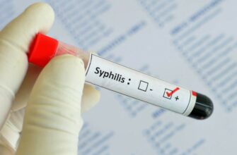 Профилактика сифилиса